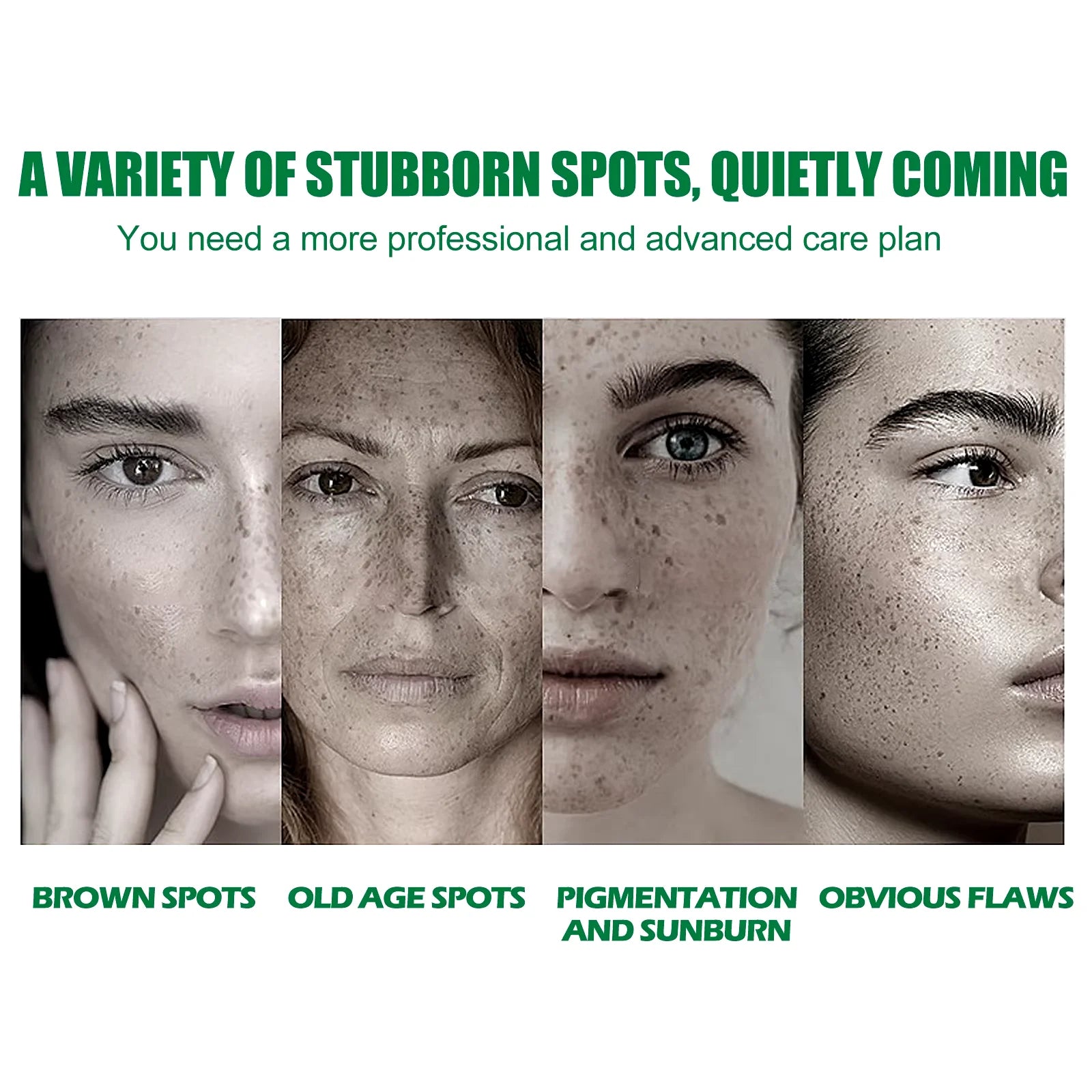 Dark Spot Correcting Glow Serum Fade Pigment Freckle Melasma Melanin Improves Dull Skin Facial Whitening Brightening Essence